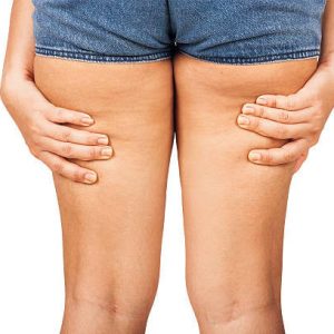 Credi sia troppo presto per pensare a tuo corpo?