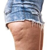 Gambe grosse